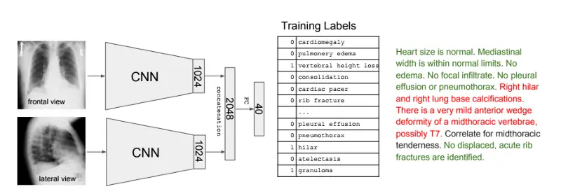TextRay architecture